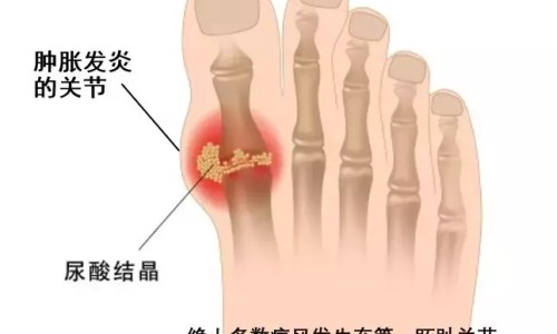 艾滋病人唾液有没有病毒-艾滋病人的唾液传染吗网 - 艾滋病唾液传播的概率有多大,艾滋病人的唾液传染吗会传染吗